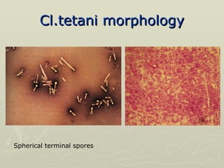 Cl.tetani morphology Spherical terminal spores 