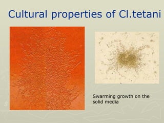 Cultural   properties of Cl.tetani Swarming growth on the solid media 