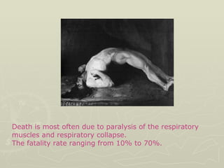 Death is most often due to paralysis of the respiratory muscles and respiratory collapse.  The fatality rate ranging from 10% to 70%. 