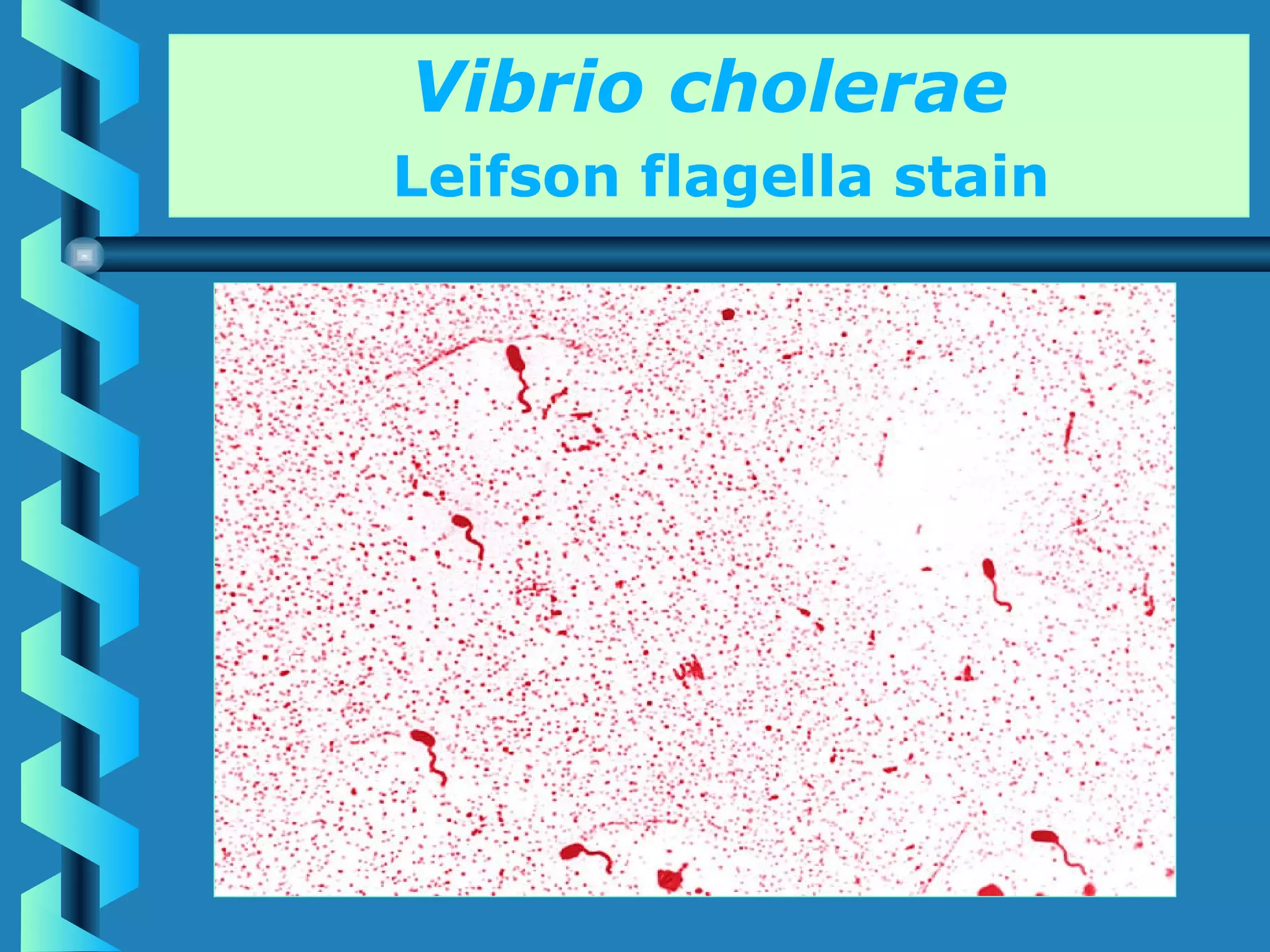 Lecture 21 Vibrio cholerae | PPT