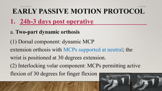 lecture 21(Extensor Tendon Injuries) .pdf
