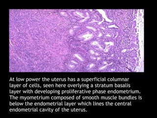 At low power the uterus has a superficial columnar layer of cells, seen here overlying a stratum basalis layer with develo...