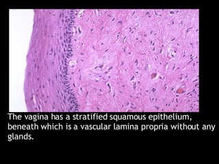 The vagina has a stratified squamous epithelium, beneath which is a vascular lamina propria without any glands. 