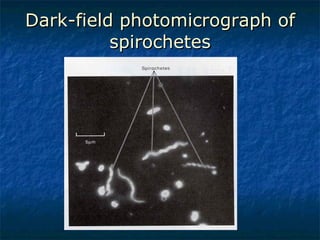 Dark-field photomicrograph of spirochetes 