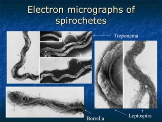 Electron micrographs of spirochetes Treponema  Borrelia  Leptospira  