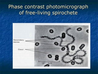 Phase contrast photomicrograph of free-living spirochete 