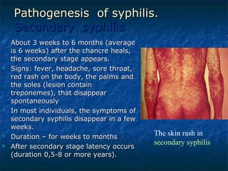 Pathogenesis  of syphilis. Secondary  syphilis About 3 weeks to 6 months (average is 6 weeks) after the chancre heals, the secondary stage appears.  Signs: fever, headache, sore throat, red rash on the body, the palms and the soles (lesion contain treponemes), that disappear spontaneously  In most individuals, the symptoms of secondary syphilis disappear in a few weeks.  Duration – for weeks to months After secondary stage latency occurs (duration 0,5-8 or more years). The skin rash in  secondary syphilis  