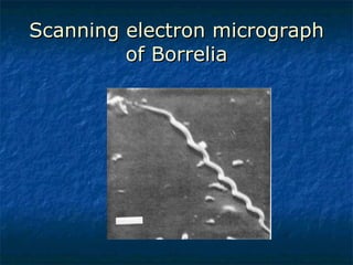 Scanning electron micrograph of Borrelia 