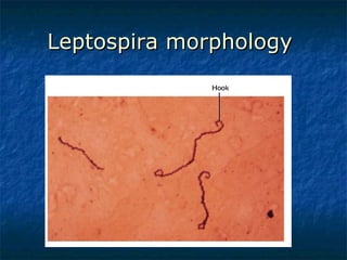 Leptospira morphology  