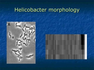 Helicobacter morphology 