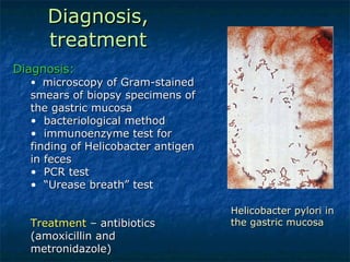 Diagnosis, treatment Helicobacter pylori in the gastric mucosa Diagnosis:  microscopy of Gram-stained smears of biopsy specimens of the gastric mucosa bacteriological method immunoenzyme test for finding of Helicobacter antigen in feces PCR test “ Urease breath” test Treatment  – antibiotics (amoxicillin and metronidazole) 