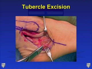 Lecture 23 24 parekh peroneal pathology | PPTX