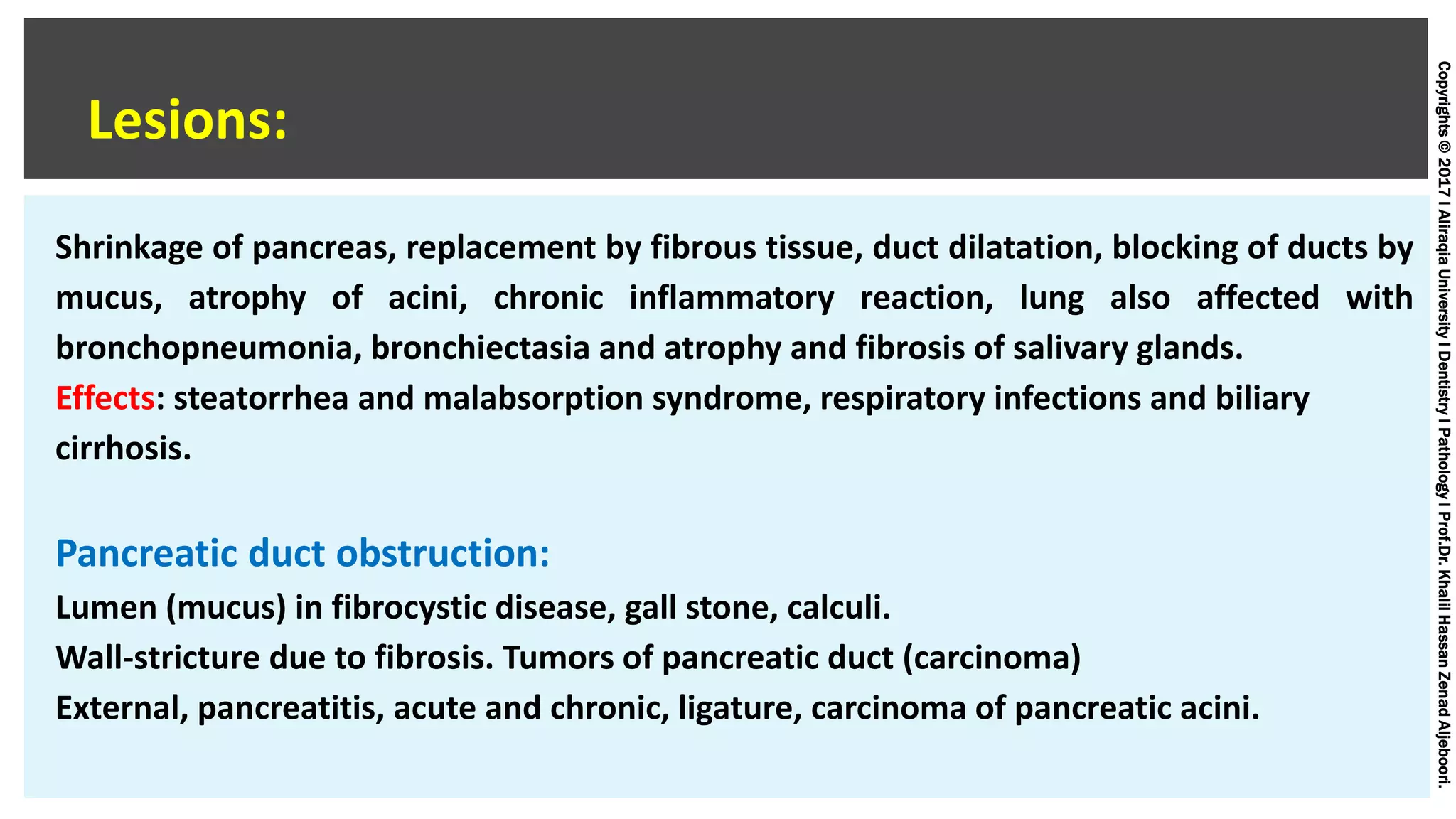 Copyrights©2017lAliraqiaUniversitylDentistrylPathologylProf.Dr.KhalilHassanZenadAljeboori.
Shrinkage of pancreas, replacement by fibrous tissue, duct dilatation, blocking of ducts by
mucus, atrophy of acini, chronic inflammatory reaction, lung also affected with
bronchopneumonia, bronchiectasia and atrophy and fibrosis of salivary glands.
Effects: steatorrhea and malabsorption syndrome, respiratory infections and biliary
cirrhosis.
Pancreatic duct obstruction:
Lumen (mucus) in fibrocystic disease, gall stone, calculi.
Wall-stricture due to fibrosis. Tumors of pancreatic duct (carcinoma)
External, pancreatitis, acute and chronic, ligature, carcinoma of pancreatic acini.
Lesions:
 