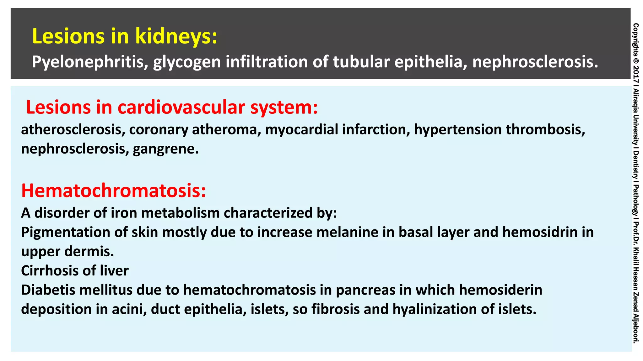 Copyrights©2017lAliraqiaUniversitylDentistrylPathologylProf.Dr.KhalilHassanZenadAljeboori.
Lesions in kidneys:
Pyelonephritis, glycogen infiltration of tubular epithelia, nephrosclerosis.
Lesions in cardiovascular system:
atherosclerosis, coronary atheroma, myocardial infarction, hypertension thrombosis,
nephrosclerosis, gangrene.
Hematochromatosis:
A disorder of iron metabolism characterized by:
Pigmentation of skin mostly due to increase melanine in basal layer and hemosidrin in
upper dermis.
Cirrhosis of liver
Diabetis mellitus due to hematochromatosis in pancreas in which hemosiderin
deposition in acini, duct epithelia, islets, so fibrosis and hyalinization of islets.
 