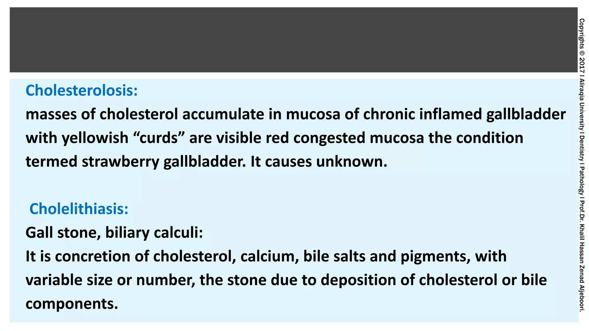 Copyrights©2017lAliraqiaUniversitylDentistrylPathologylProf.Dr.KhalilHassanZenadAljeboori.
Cholesterolosis:
masses of cholesterol accumulate in mucosa of chronic inflamed gallbladder
with yellowish “curds” are visible red congested mucosa the condition
termed strawberry gallbladder. It causes unknown.
Cholelithiasis:
Gall stone, biliary calculi:
It is concretion of cholesterol, calcium, bile salts and pigments, with
variable size or number, the stone due to deposition of cholesterol or bile
components.
 