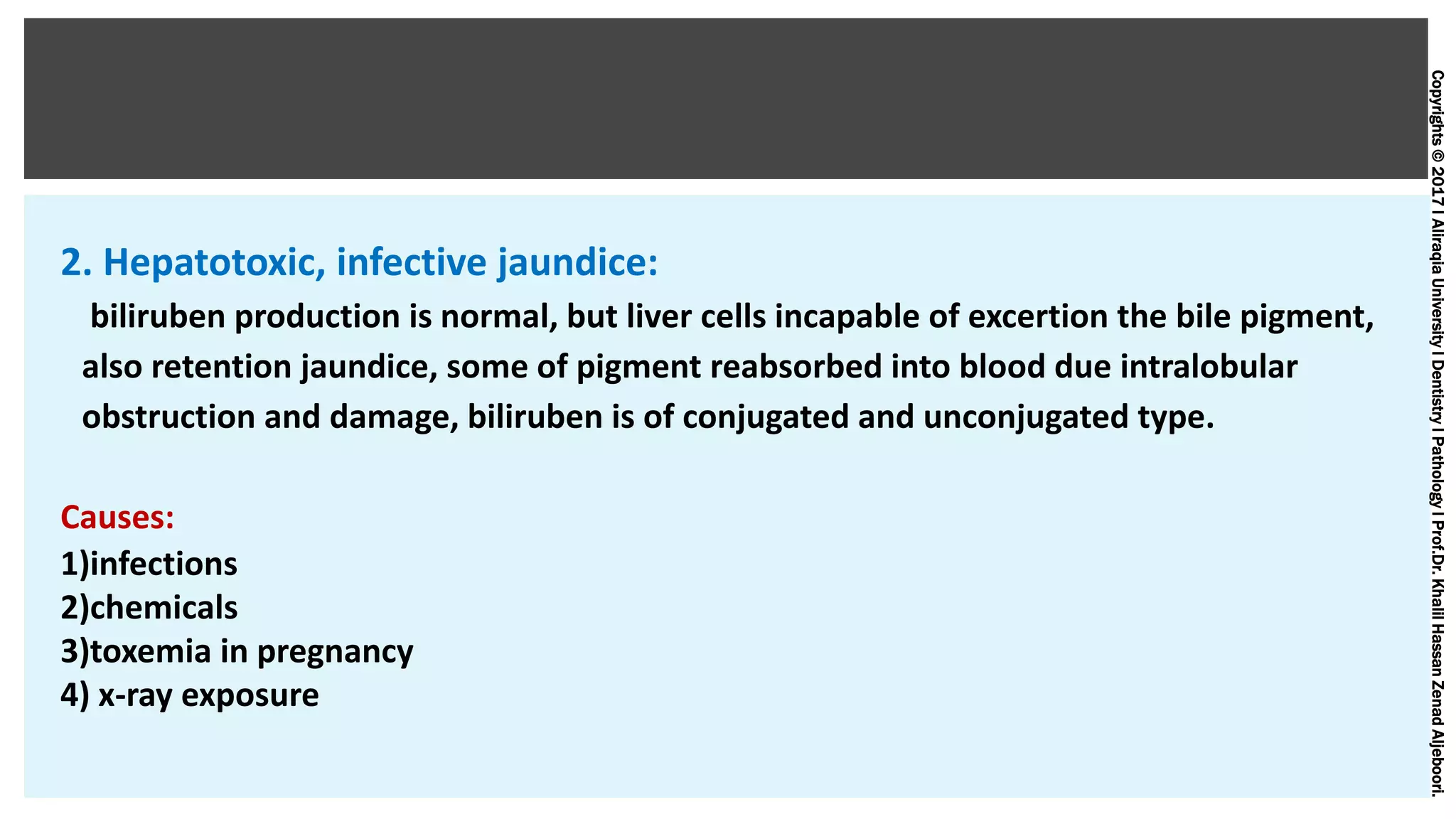 Copyrights©2017lAliraqiaUniversitylDentistrylPathologylProf.Dr.KhalilHassanZenadAljeboori.
2. Hepatotoxic, infective jaundice:
biliruben production is normal, but liver cells incapable of excertion the bile pigment,
also retention jaundice, some of pigment reabsorbed into blood due intralobular
obstruction and damage, biliruben is of conjugated and unconjugated type.
Causes:
1)infections
2)chemicals
3)toxemia in pregnancy
4) x-ray exposure
 