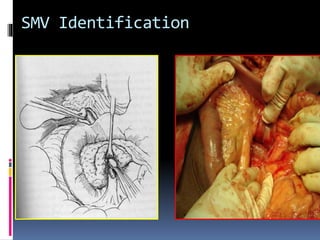 SMV Identification
 