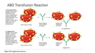 ABO Transfusion Reaction
 