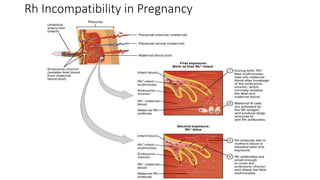 Rh Incompatibility in Pregnancy
 