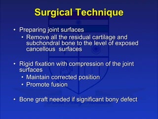 Surgical Technique
• Preparing joint surfaces
• Remove all the residual cartilage and
subchondral bone to the level of exp...