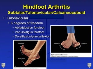 Hindfoot Arthritis
Subtalar/Talonavicular/Calcaneocuboid
• Talonavicular
• 6 degrees of freedom
• Ab/adduction forefoot
• ...