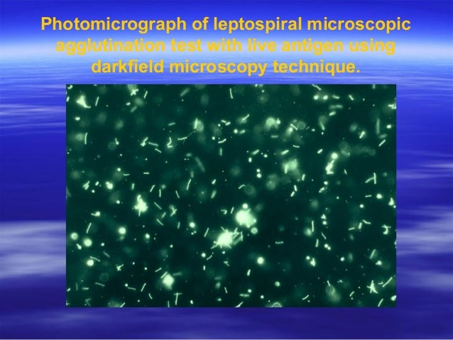 9 blood week test Leptospira 28 Lecture