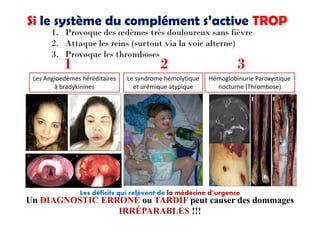 Taux de mo
Perte de l’o
Incidence=
2/million
du larynx
raîner une
Les crises
dème
les
entraîner
rgie inutile
ard dans le
c,
nce aux
es due à
ur intense;
attaques
peuvent
gurantes et
es
mortalité
4H):15–
Les Angioedèmes héréditaires
à bradykinines
Le syndrome hémolytique
et urémique atypique
Hémoglobinurie Paroxystique
nocturne (Thrombose)
Si le système du complément s’active TROP
1. Provoque des œdèmes très douloureux sans fièvre
2. Attaque les reins (surtout via la voie alterne)
3. Provoque les thromboses
1 2 3
Taux de mo
Perte de l’o
Echec
transplanta
=90%
Incidence=
2/million
du larynx
raîner une
Les crises
dème
les
entraîner
rgie inutile
ard dans le
c,
nce aux
es due à
ur intense;
attaques
peuvent
gurantes et
es
Les déficits qui relèvent de la médecine d’urgence
Un DIAGNOSTIC ERRONÉ ou TARDIF peut causer des dommages
IRRÉPARABLES !!!
 