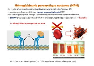 Hémoglobinurie paroxystique nocturne (HPN)
– mutation entraînant un déficit en glycosyl phosphatidylinositol (GPI)
–GPI sert de glycolipide d'ancrage à différents récepteurs cellulaires dont CD55 et CD59
=> DÉFAUT d'expression de CD55 et CD59 => activation incontrôlée du complément => hémolyse
=> Hémoglobinurie paroxystique nocturne
Elle résulte d’une mutation somatique touchant une la molécule d’ancrage GPI
CD55 (Decay Accelerating Factor) et CD59 (Membrane Inhibitor of Reactive Lysis)
 