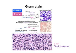 Gram stain
E coli
Staphylococcus
 
