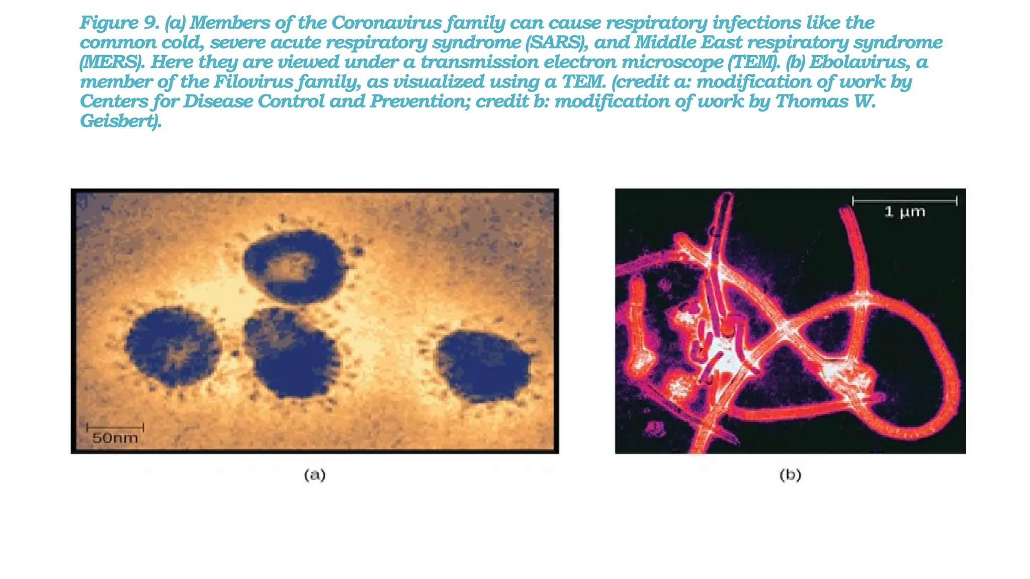 Figure 9. (a) Members of the Coronavirus family can cause respiratory infections like the
common cold, severe acute respiratory syndrome (SARS), and Middle East respiratory syndrome
(MERS). Here they are viewed under a transmission electron microscope (TEM). (b) Ebolavirus, a
member of the Filovirus family, as visualized using a TEM. (credit a: modification of work by
Centers for Disease Control and Prevention; credit b: modification of work by Thomas W.
Geisbert).
 