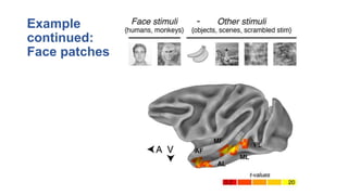 Neural Basis of Cognition: Understanding Capgras Syndrome and Brain ...
