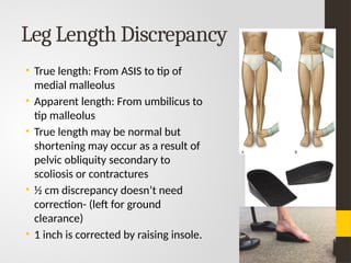 Lecture#2 Orthopedic Footwear and Shoe Modifications.pptx