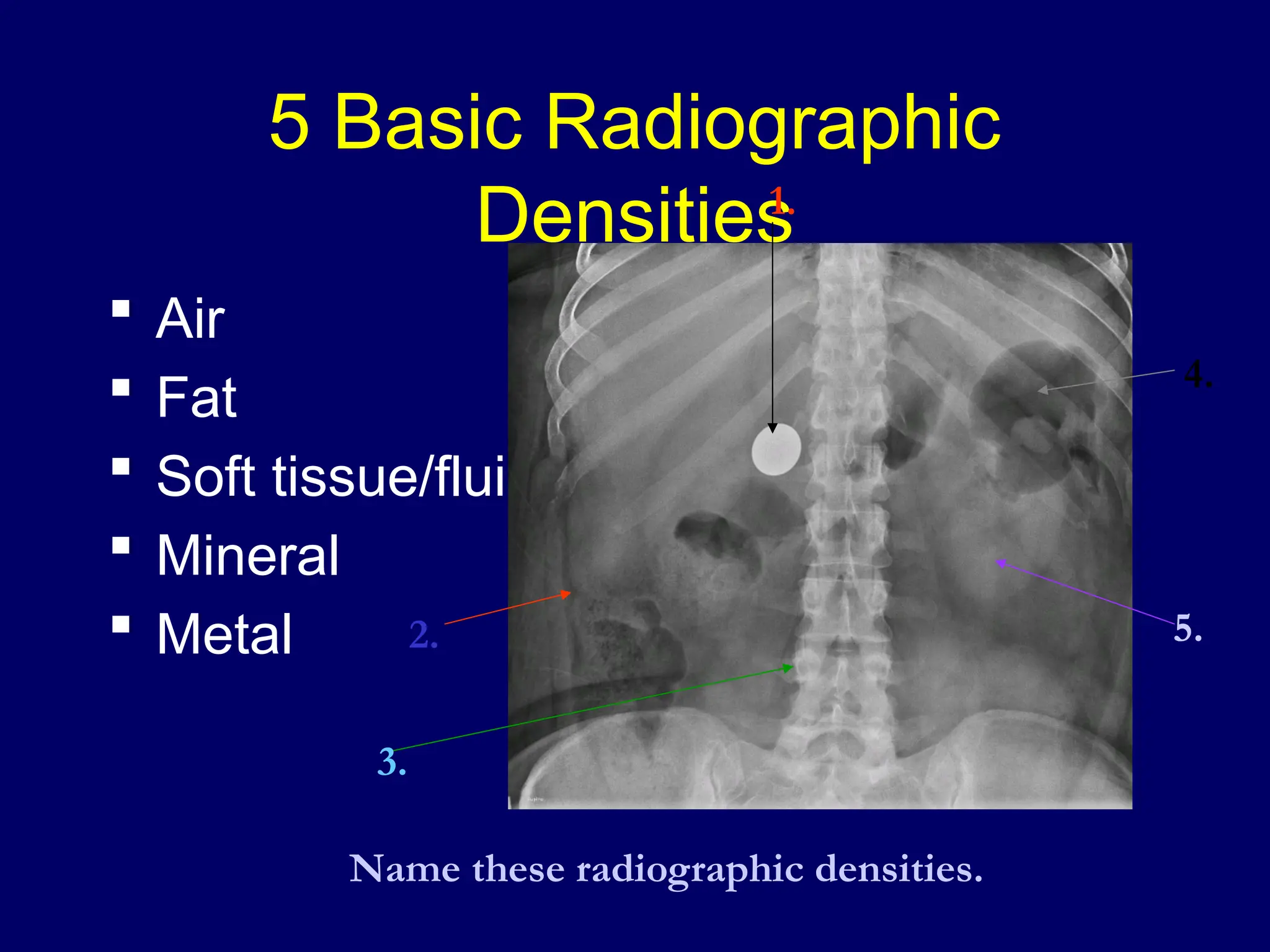 5 Basic Radiographic
Densities
 Air
 Fat
 Soft tissue/fluid
 Mineral
 Metal
1.
2.
3.
4.
5.
Name these radiographic densities.
 