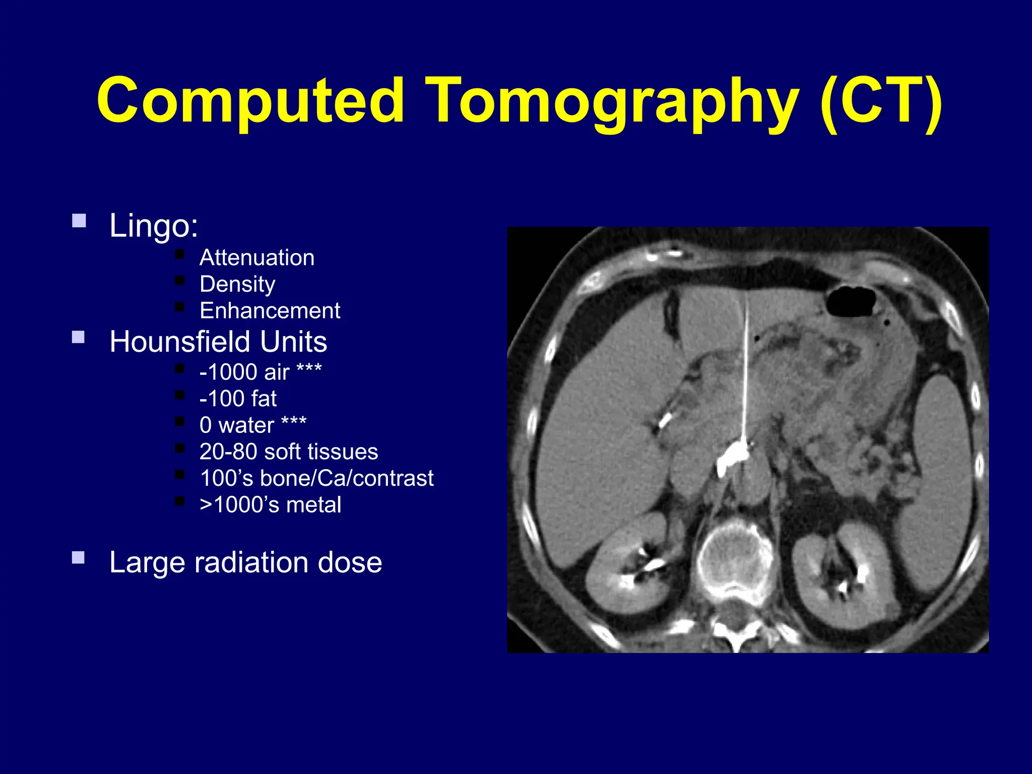 Computed Tomography (CT)
 Lingo:
 Attenuation
 Density
 Enhancement
 Hounsfield Units
 -1000 air ***
 -100 fat
 0 water ***
 20-80 soft tissues
 100’s bone/Ca/contrast
 >1000’s metal
 Large radiation dose
 