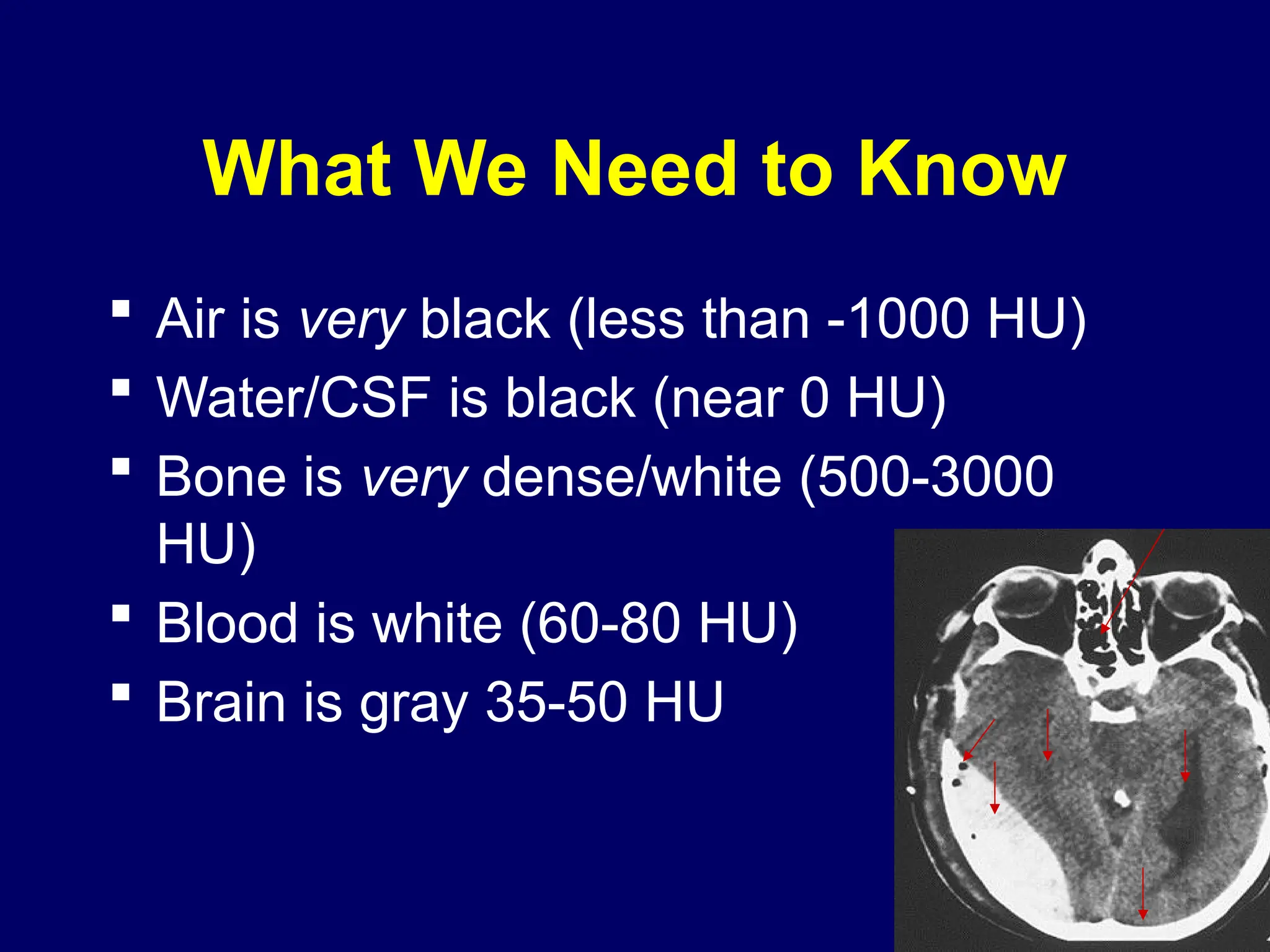 What We Need to Know
 Air is very black (less than -1000 HU)
 Water/CSF is black (near 0 HU)
 Bone is very dense/white (500-3000
HU)
 Blood is white (60-80 HU)
 Brain is gray 35-50 HU
 