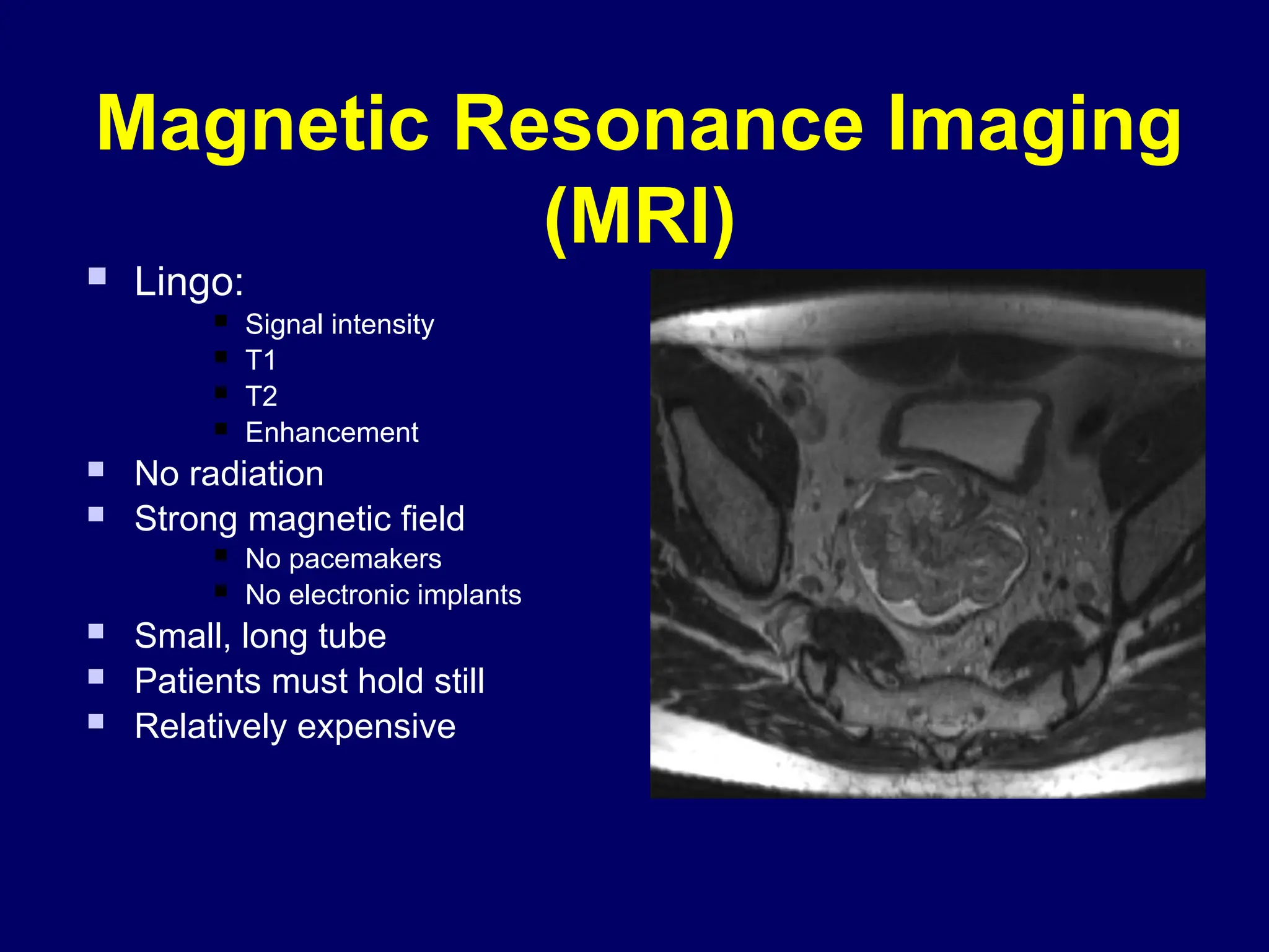 Magnetic Resonance Imaging
(MRI)
 Lingo:
 Signal intensity
 T1
 T2
 Enhancement
 No radiation
 Strong magnetic field
 No pacemakers
 No electronic implants
 Small, long tube
 Patients must hold still
 Relatively expensive
 