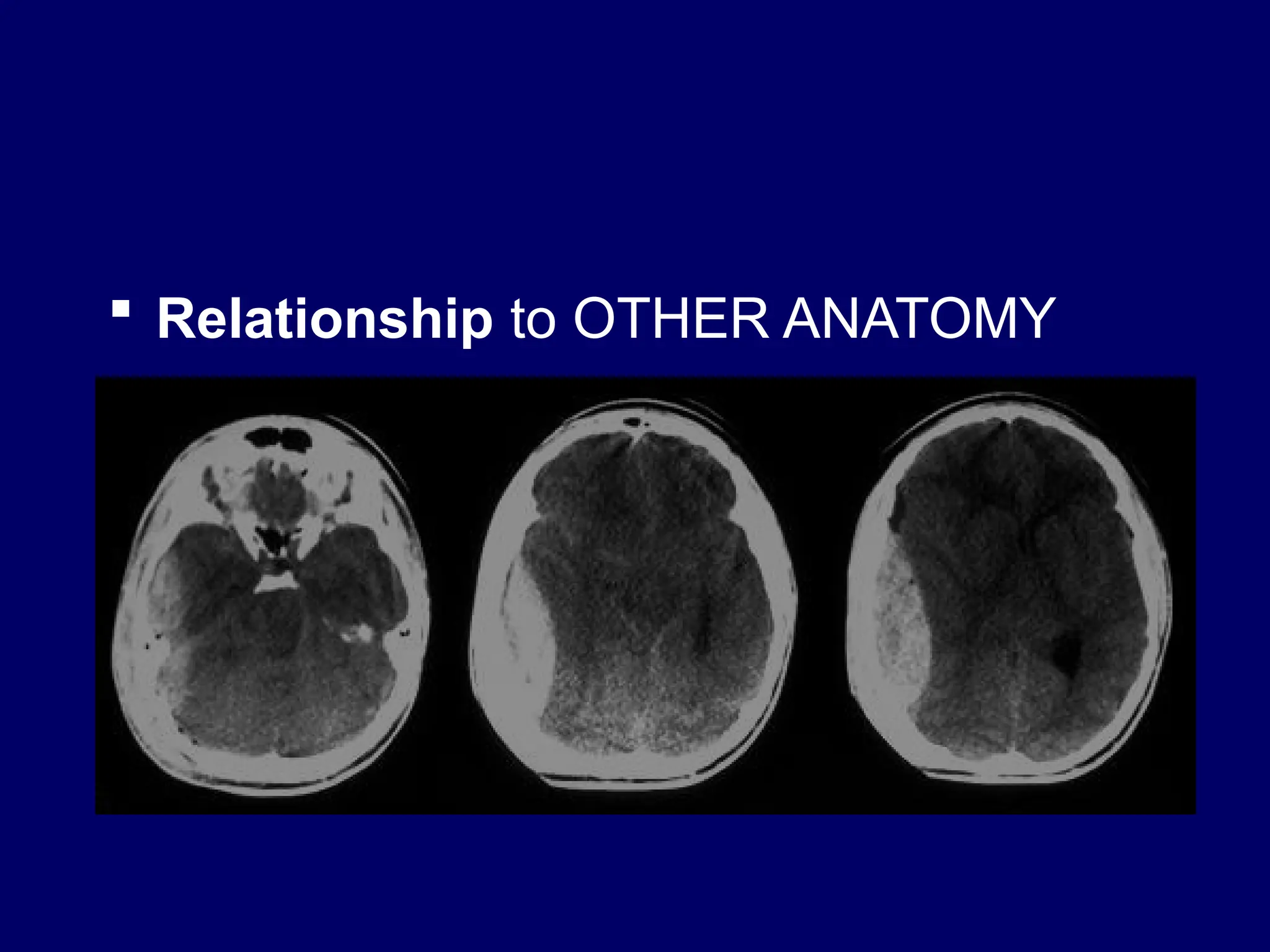 Relationship to OTHER ANATOMY
 