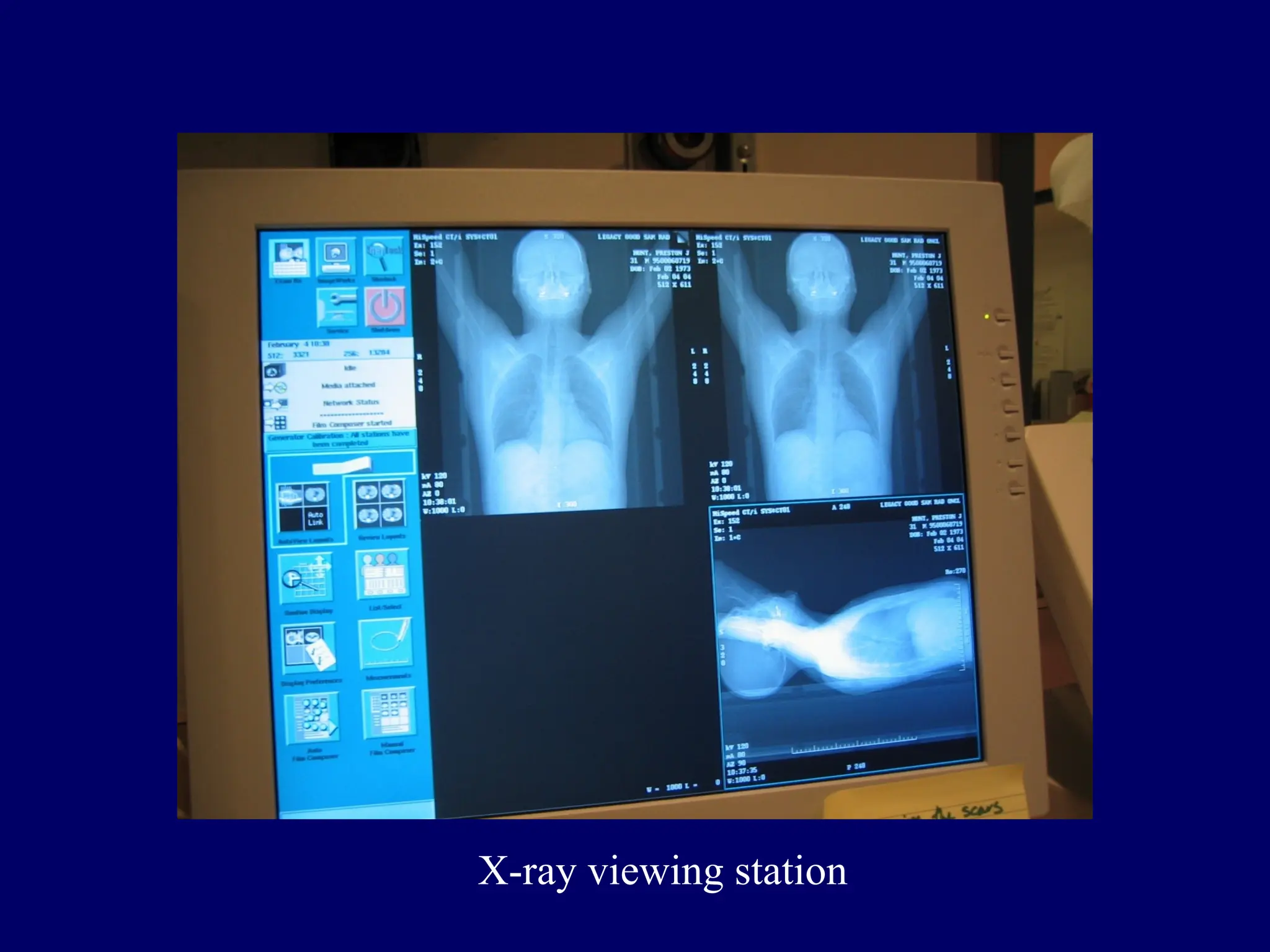 X-ray viewing station
 