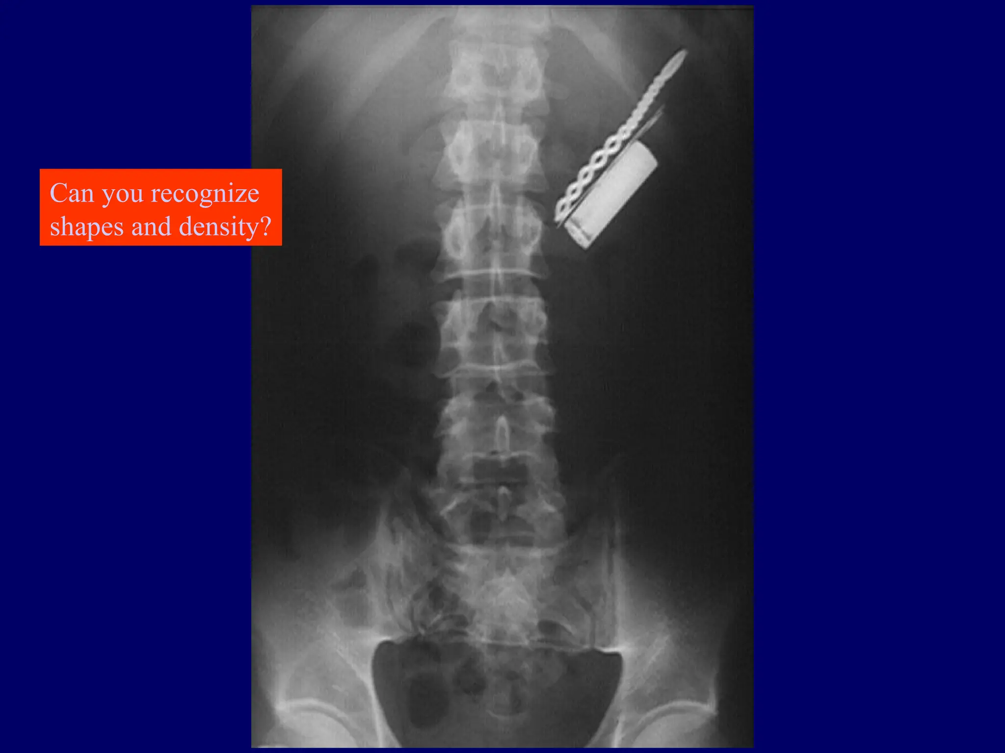 Can you recognize
shapes and density?
 