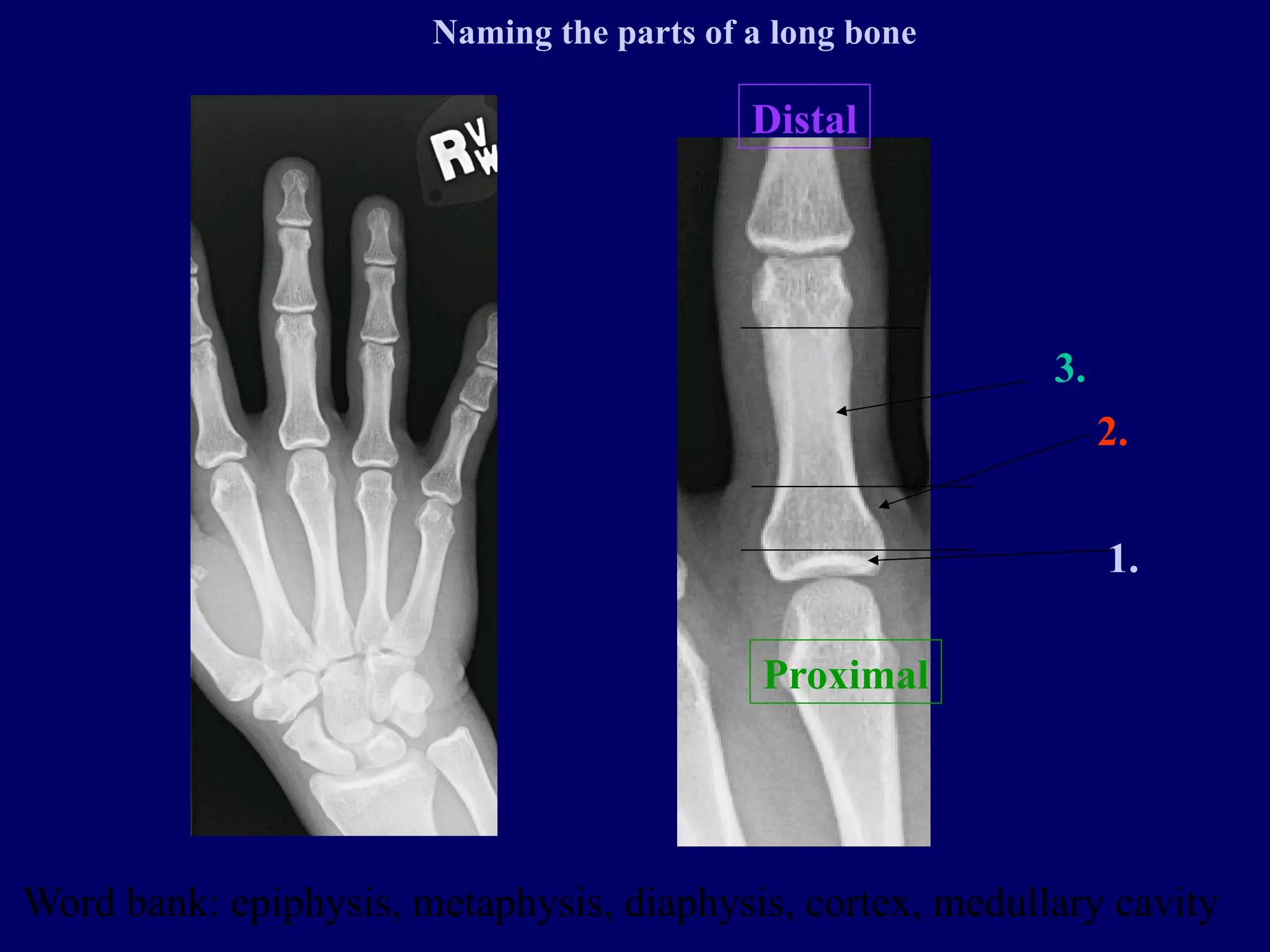Proximal
Distal
1.
2.
3.
Word bank: epiphysis, metaphysis, diaphysis, cortex, medullary cavity
Naming the parts of a long bone
 