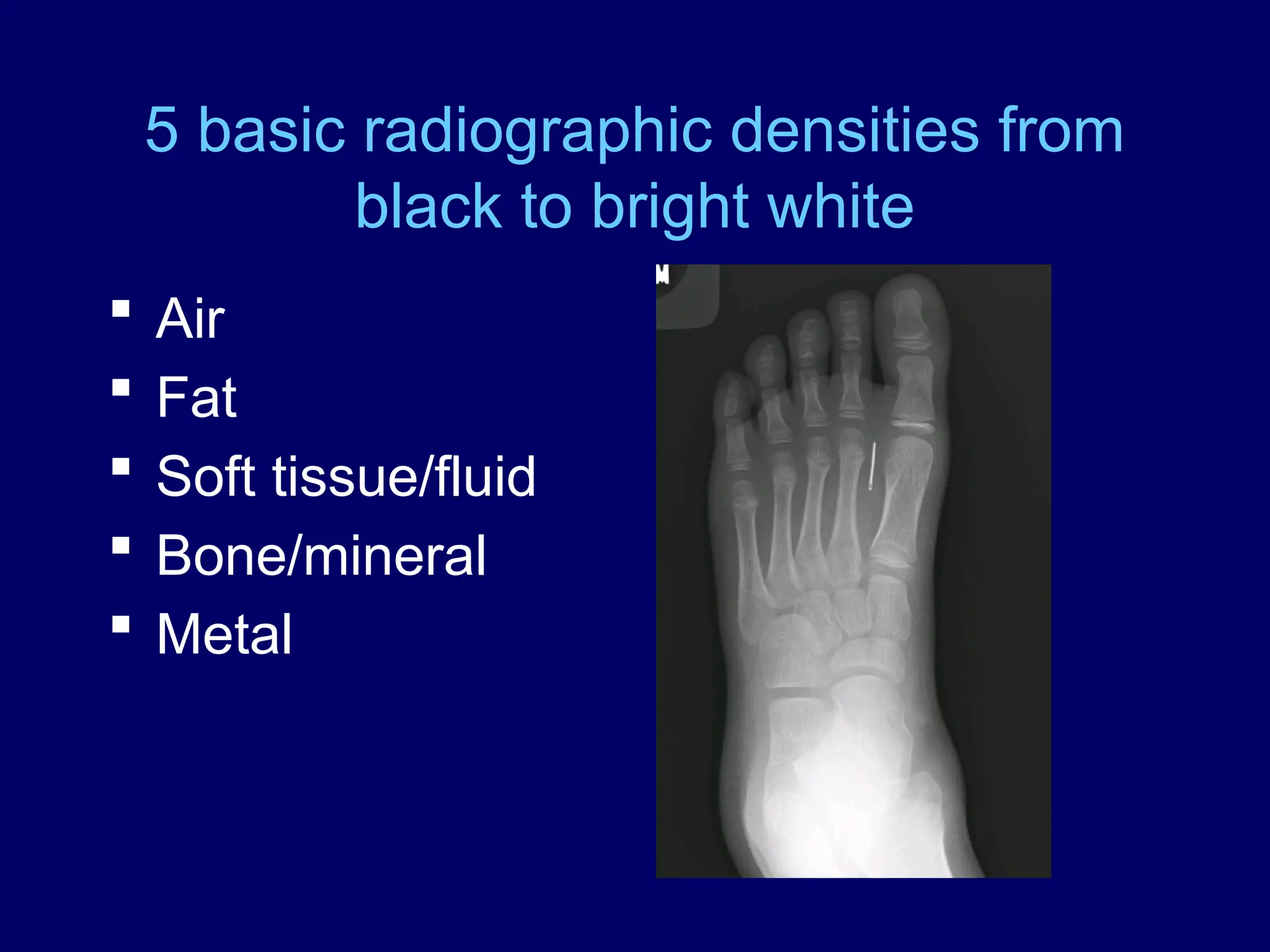 5 basic radiographic densities from
black to bright white
 Air
 Fat
 Soft tissue/fluid
 Bone/mineral
 Metal
 