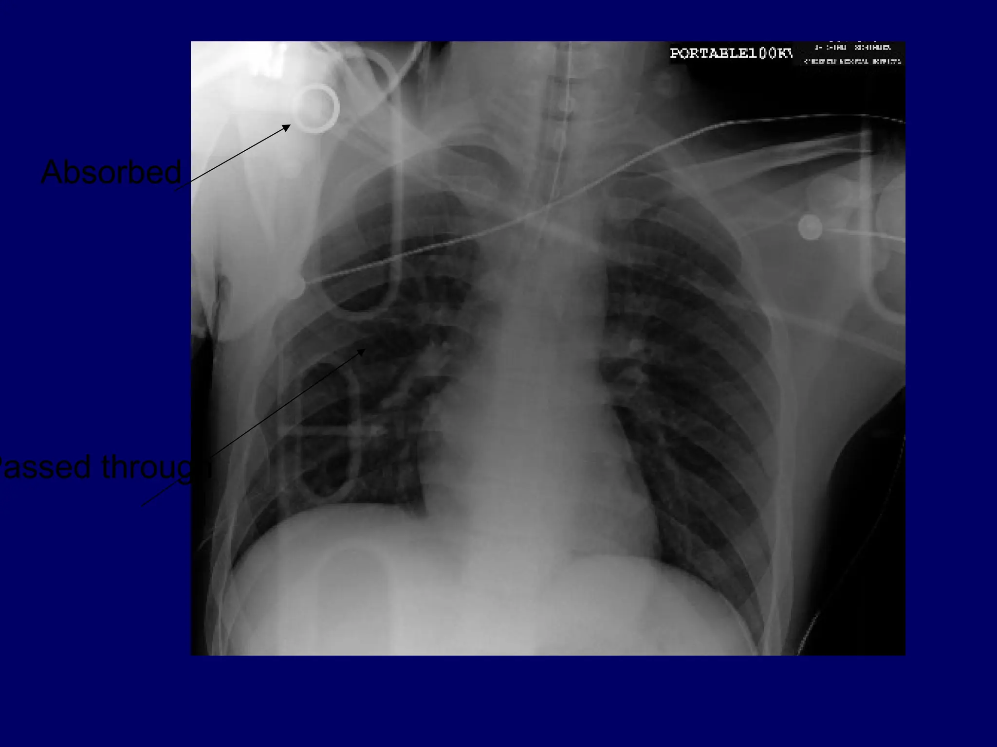 Absorbed
Passed through
 