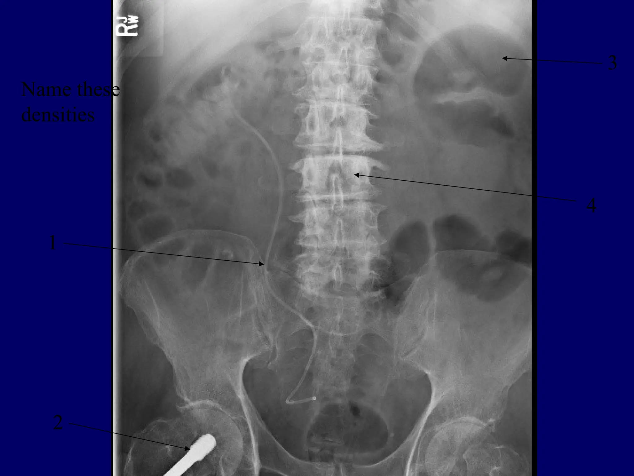 2
4
3
1
Name these
densities
 