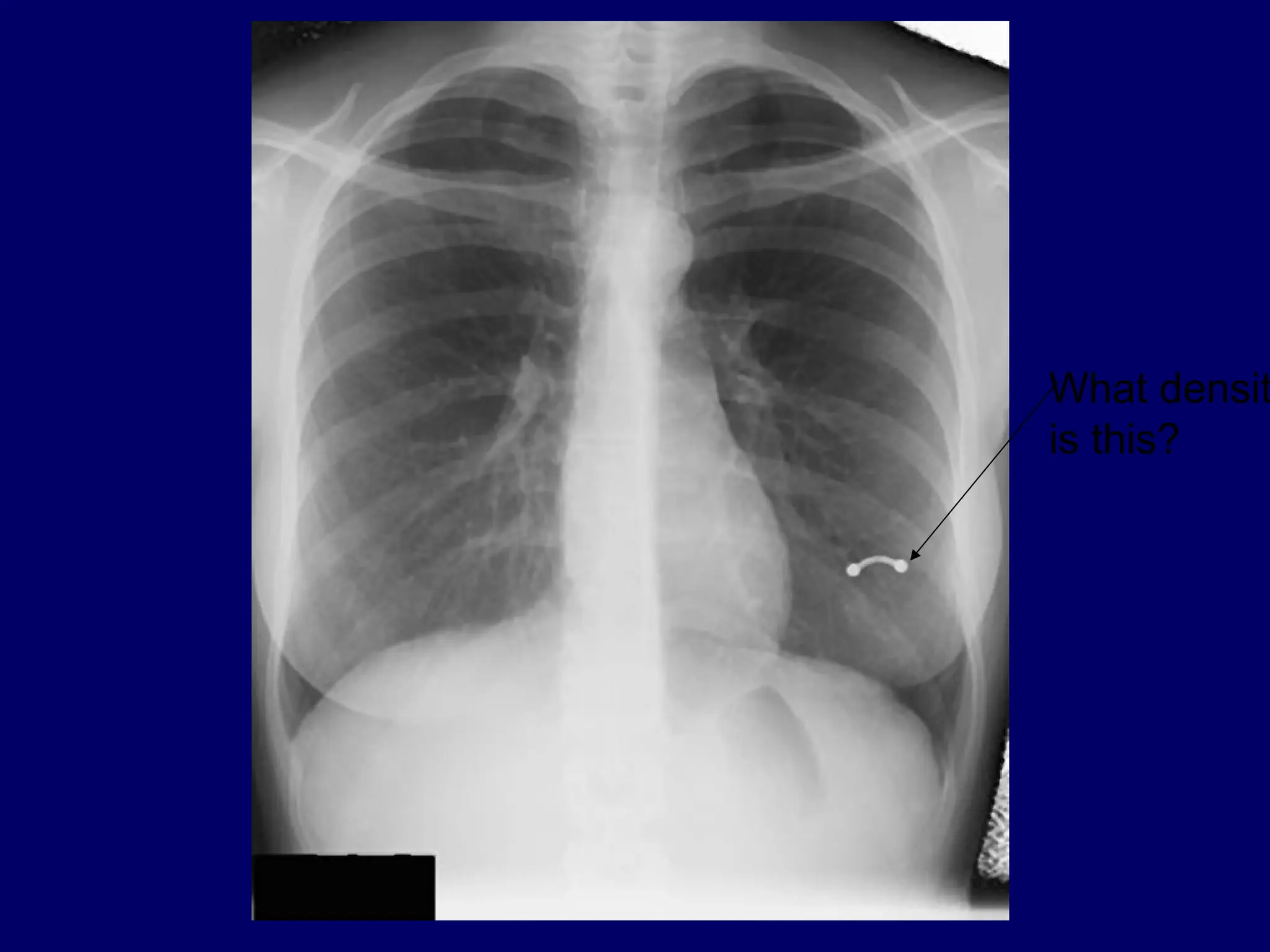 What densit
is this?
 