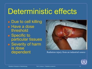 Radiation Protection in Radiotherapy Part 3, lecture 1: Radiation protection 13
Deterministic effects
 Due to cell killing
 Have a dose
threshold
 Specific to
particular tissues
 Severity of harm
is dose
dependent Radiation injury from an industrial source
 
