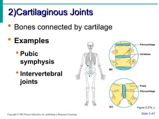 Symphysis Examples Lecture 2 (Skeletal System ) 3.ppt ١٢٣٤٦ | PPT