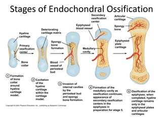 Stages of Endochondral Ossification                                 Secondary            Articular
                                                                     ossification         cartilage
                                                                     center
                                                          Epiphyseal                      Spongy
                            Deteriorating                 blood vessel                    bone
         Hyaline            cartilage matrix
         cartilage
                                     Spongy                                               Epiphyseal
                                     bone                                                 plate
         Primary
                                     formation                                            cartilage
         ossification                                          Medullary
         center                                                cavity


          Bone                       Blood
          collar                     vessel of
                                     periosteal
                                     bud
1 Formation
  of bone            2 Cavitation
  collar                of the              3 Invasion of
  around                hyaline                internal cavities    4 Formation of the
  hyaline               cartilage              by the                    medullary cavity as          5 Ossification of the
  cartilage             within the             periosteal bud            ossification continues;        epiphyses; when
  model.                cartilage              and spongy                appearance of                  completed, hyaline
                        model.                 bone formation.           secondary ossification         cartilage remains
                                                                         centers in the                 only in the
                                                                         epiphyses in                   epiphyseal plates
                                                                         preparation for stage 5.       and articular
                                                                                                        cartilages
 