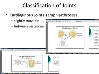 Classification of Joints
• Cartilaginous Joints (amphiarthroses)
  – slightly movable
  – between vertebrae
 