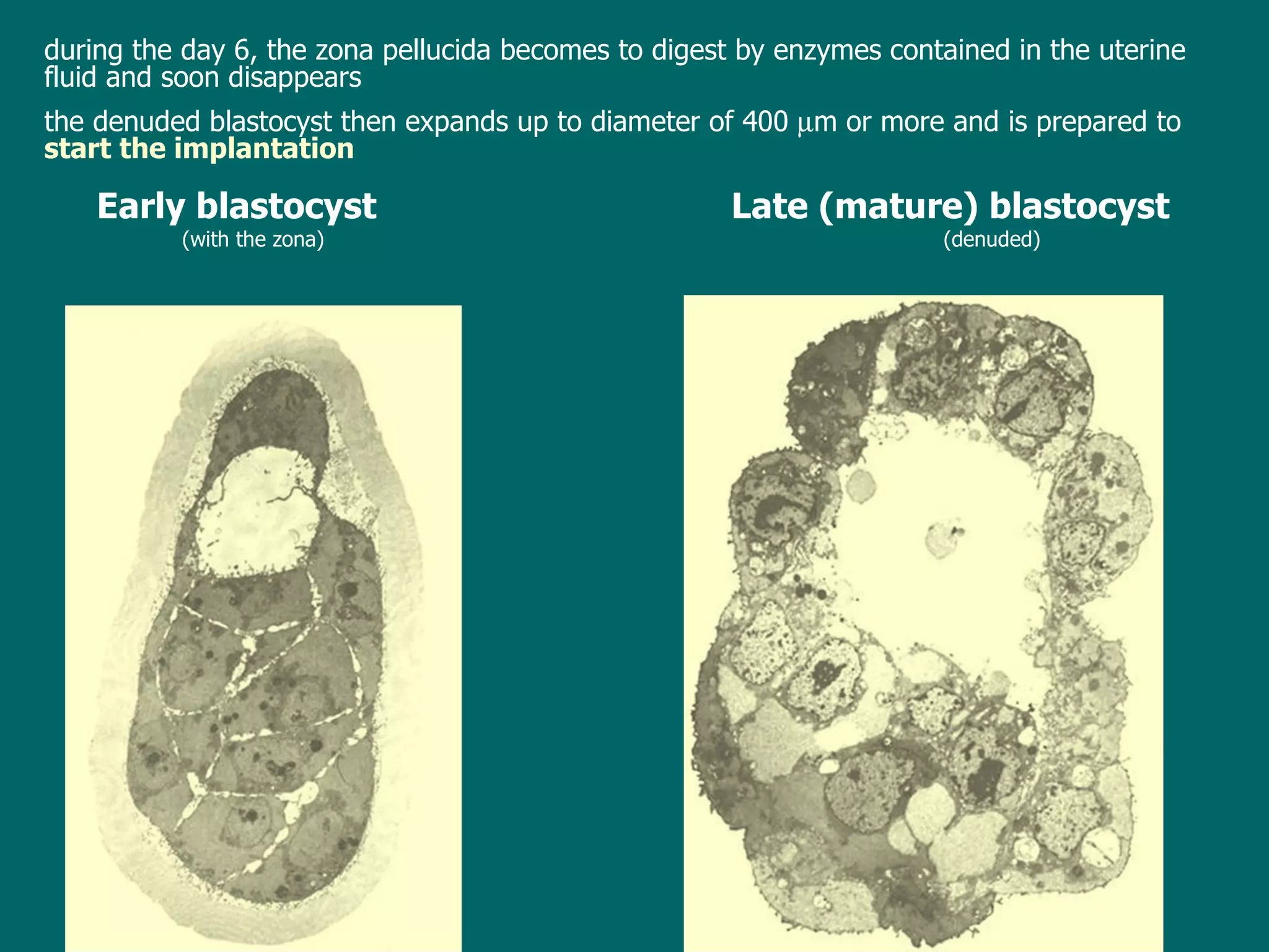 Early blastocyst      Late (mature) blastocyst (with the zona) (denuded) d uring the day 6 ,  the zona pellucida becomes to digest by enzymes  contained in the uterine fluid  and soon disappears t he denuded blastocyst then expands up to diameter of 400   m  or more  and is prepared to  start the implantation 