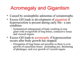 Acromegaly and Gigantism
• Caused by eosinophilic adenomas of somatotrophs
• Excess GH leads to development of gigantism if
hypersecretion is present during early life– a rare
condition
– Symmetrical enlargement of body resulting in true
giant with overgrowth of long bones, connective tissue
and visceral organs.

• Excess GH leads to acromegaly if hypersecretion
occurs after body growth has stopped.
– Elongation of long bones not possible so there is over
growth of cancellous bones– protruding jaw, thickening
of phalanges, and over growth of visceral organs

 